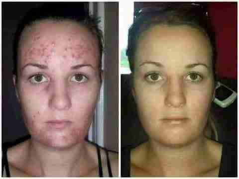 ومينس منظف البشرة لاستعادة شباب LUMINESCE YOUTH RESTORING CLEANSER
لا تنسَ أنك شاهدت هذا الإعلان في عنكبوت...