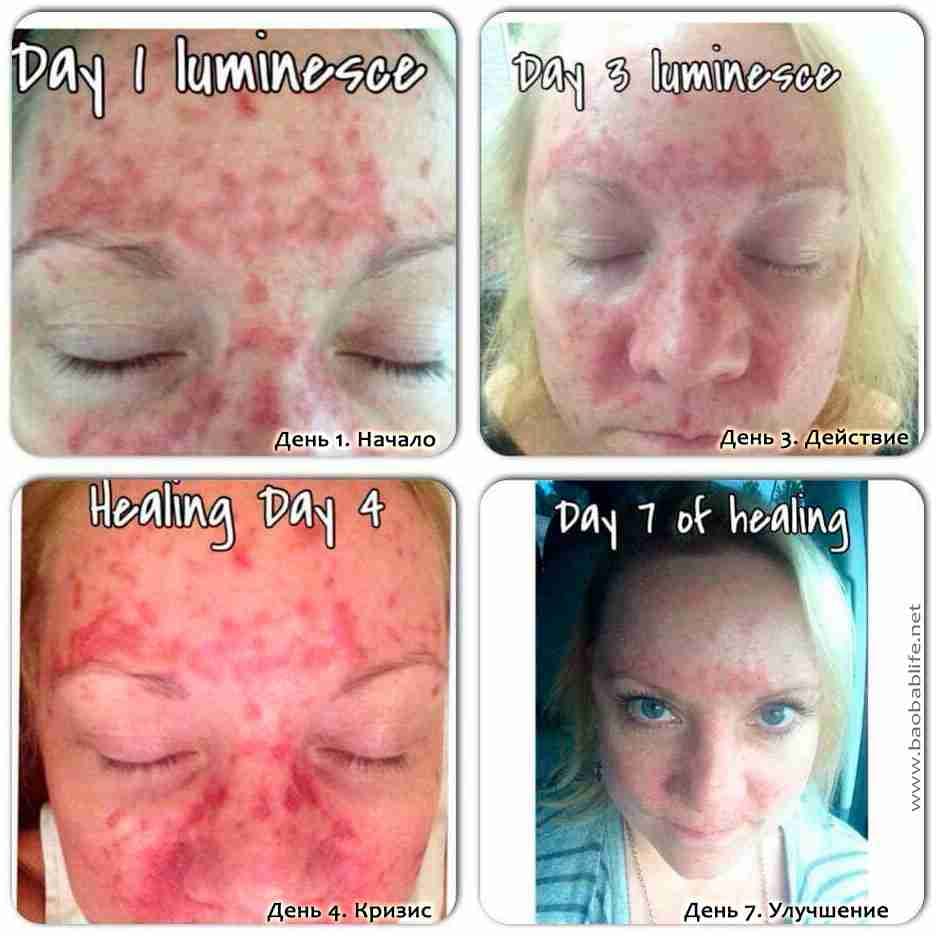 Luminesce products المنتج الامريكى
لا تنسَ أنك شاهدت هذا الإعلان في عنكبوت
مصل السيرم :- أقوي...