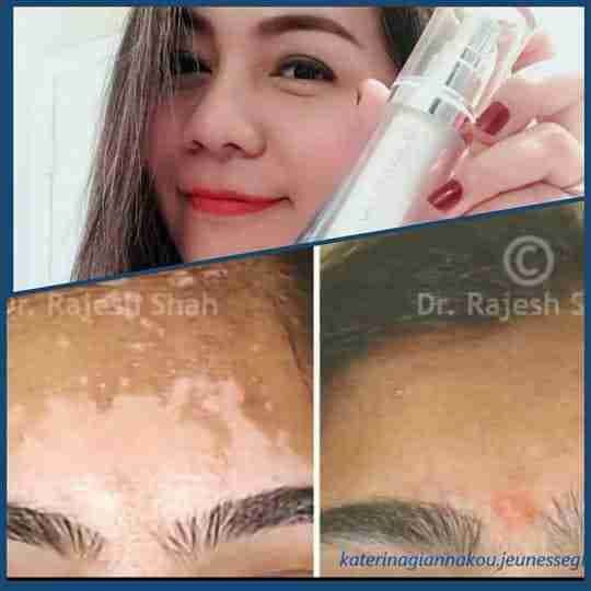 Luminesce products المنتج الامريكى
لا تنسَ أنك شاهدت هذا الإعلان في عنكبوت
مصل السيرم :- أقوي...