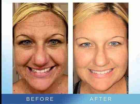 Luminesce products المنتج الامريكى
لا تنسَ أنك شاهدت هذا الإعلان في عنكبوت
مصل السيرم :- أقوي...