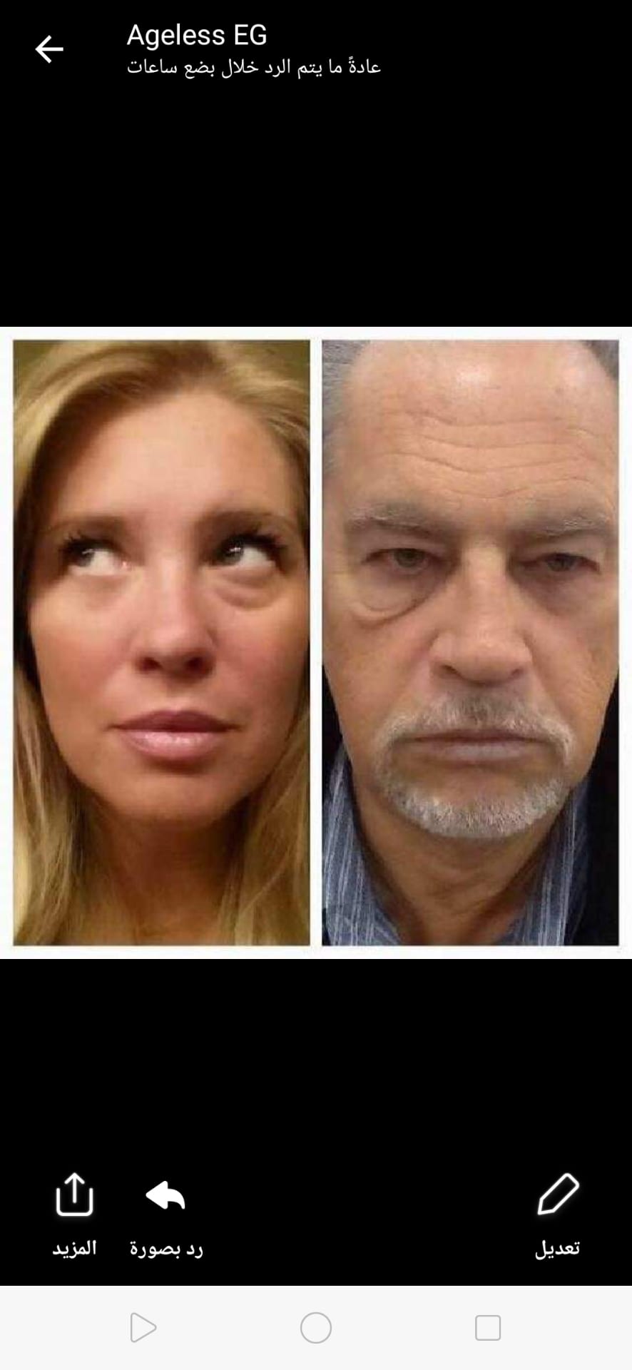 ageless cream
لا تنسَ أنك شاهدت هذا الإعلان في عنكبوت
الحل الامثل لمشكله التجاعيد و الانتفاخا...