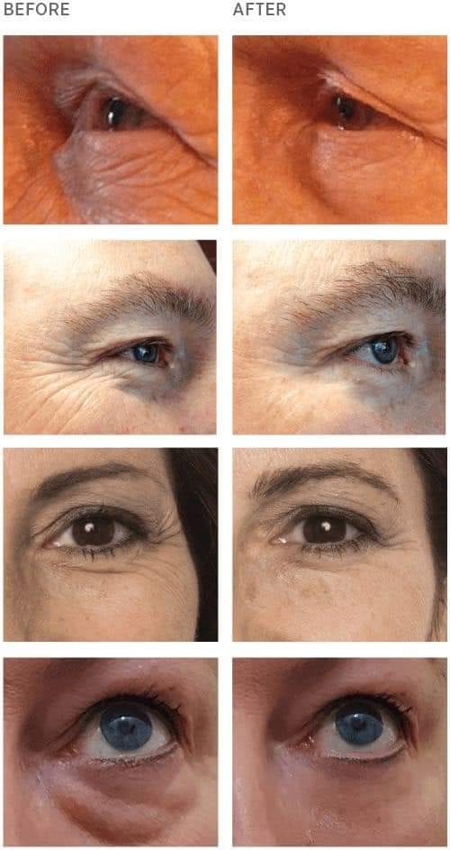 ageless cream
لا تنسَ أنك شاهدت هذا الإعلان في عنكبوت
الحل الامثل لمشكله التجاعيد و الانتفاخا...