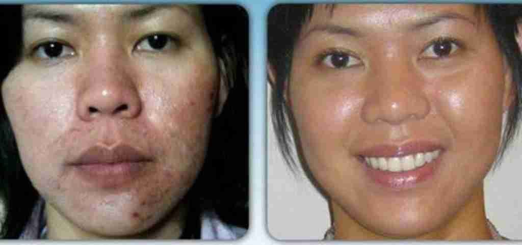 Luminesce products المنتج الامريكى
لا تنسَ أنك شاهدت هذا الإعلان في عنكبوت
مصل السيرم :- أقوي...