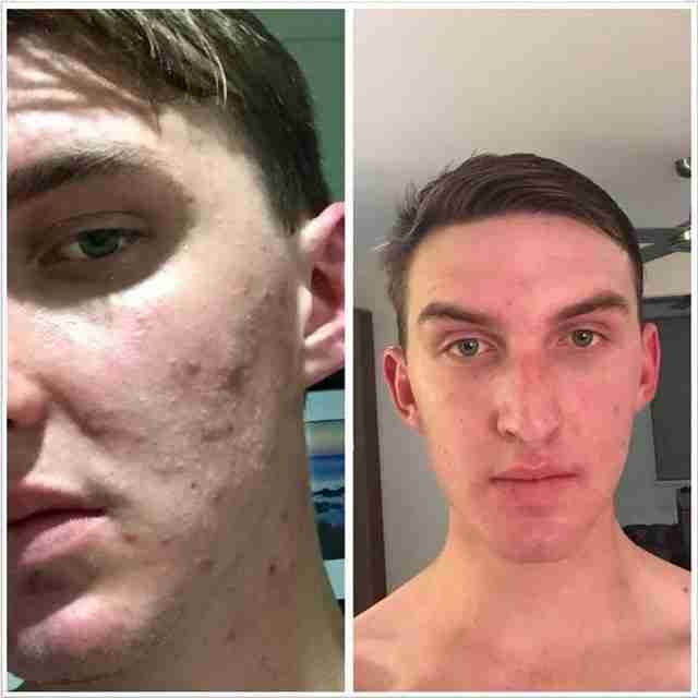 ومينس منظف البشرة لاستعادة شباب LUMINESCE YOUTH RESTORING CLEANSER
لا تنسَ أنك شاهدت هذا الإعلان في عنكبوت...