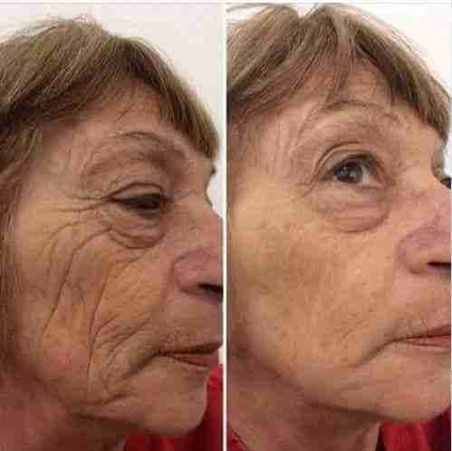 Luminesce products المنتج الامريكى
لا تنسَ أنك شاهدت هذا الإعلان في عنكبوت
مصل السيرم :- أقوي...