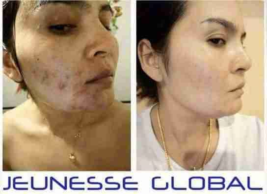 ومينس منظف البشرة لاستعادة شباب LUMINESCE YOUTH RESTORING CLEANSER
لا تنسَ أنك شاهدت هذا الإعلان في عنكبوت...