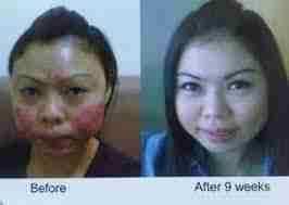Luminesce products المنتج الامريكى
لا تنسَ أنك شاهدت هذا الإعلان في عنكبوت
مصل السيرم :- أقوي...