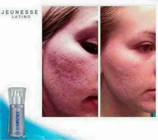 Luminesce products المنتج الامريكى
لا تنسَ أنك شاهدت هذا الإعلان في عنكبوت
مصل السيرم :- أقوي...