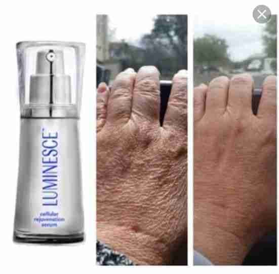 Luminesce products المنتج الامريكى
لا تنسَ أنك شاهدت هذا الإعلان في عنكبوت
مصل السيرم :- أقوي...