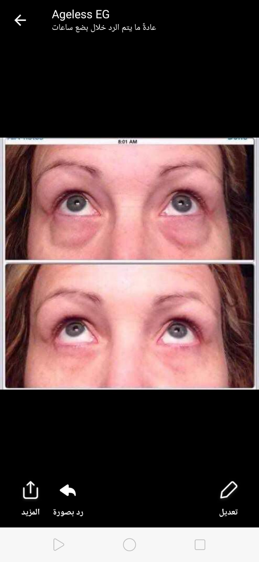 ageless cream
لا تنسَ أنك شاهدت هذا الإعلان في عنكبوت
الحل الامثل لمشكله التجاعيد و الانتفاخا...