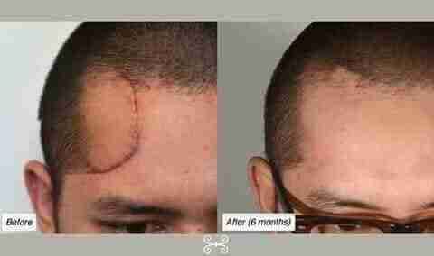 Luminesce products المنتج الامريكى
لا تنسَ أنك شاهدت هذا الإعلان في عنكبوت
مصل السيرم :- أقوي...