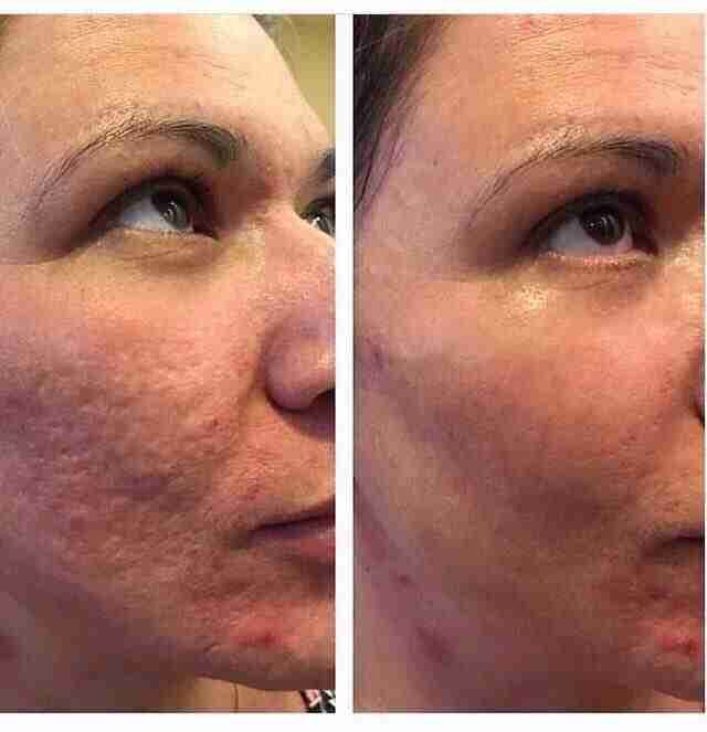 Luminesce products المنتج الامريكى
لا تنسَ أنك شاهدت هذا الإعلان في عنكبوت
مصل السيرم :- أقوي...