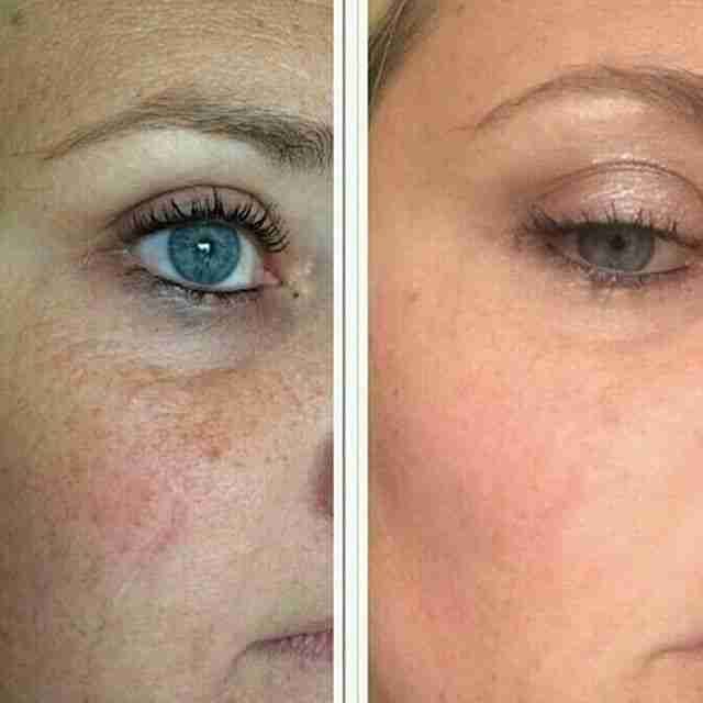 Luminesce products المنتج الامريكى
لا تنسَ أنك شاهدت هذا الإعلان في عنكبوت
مصل السيرم :- أقوي...
