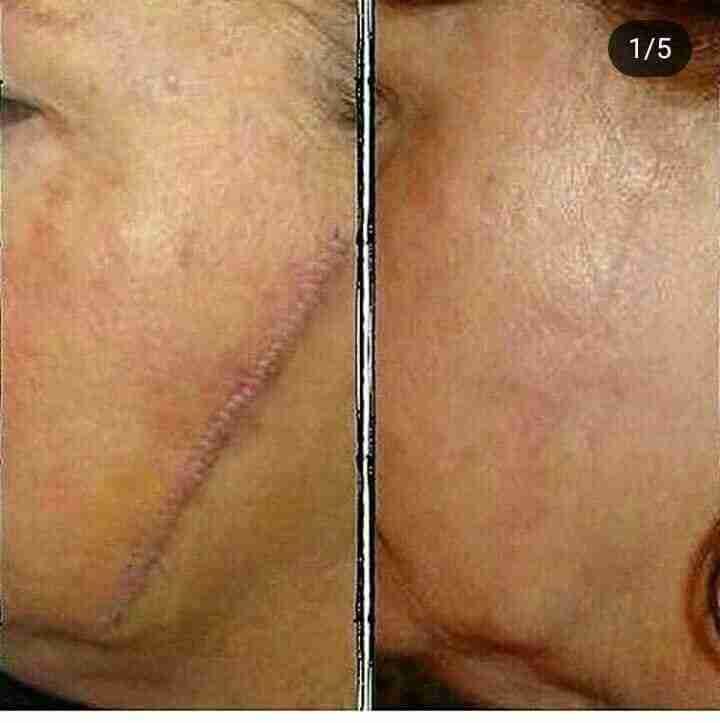 Luminesce products المنتج الامريكى
لا تنسَ أنك شاهدت هذا الإعلان في عنكبوت
مصل السيرم :- أقوي...