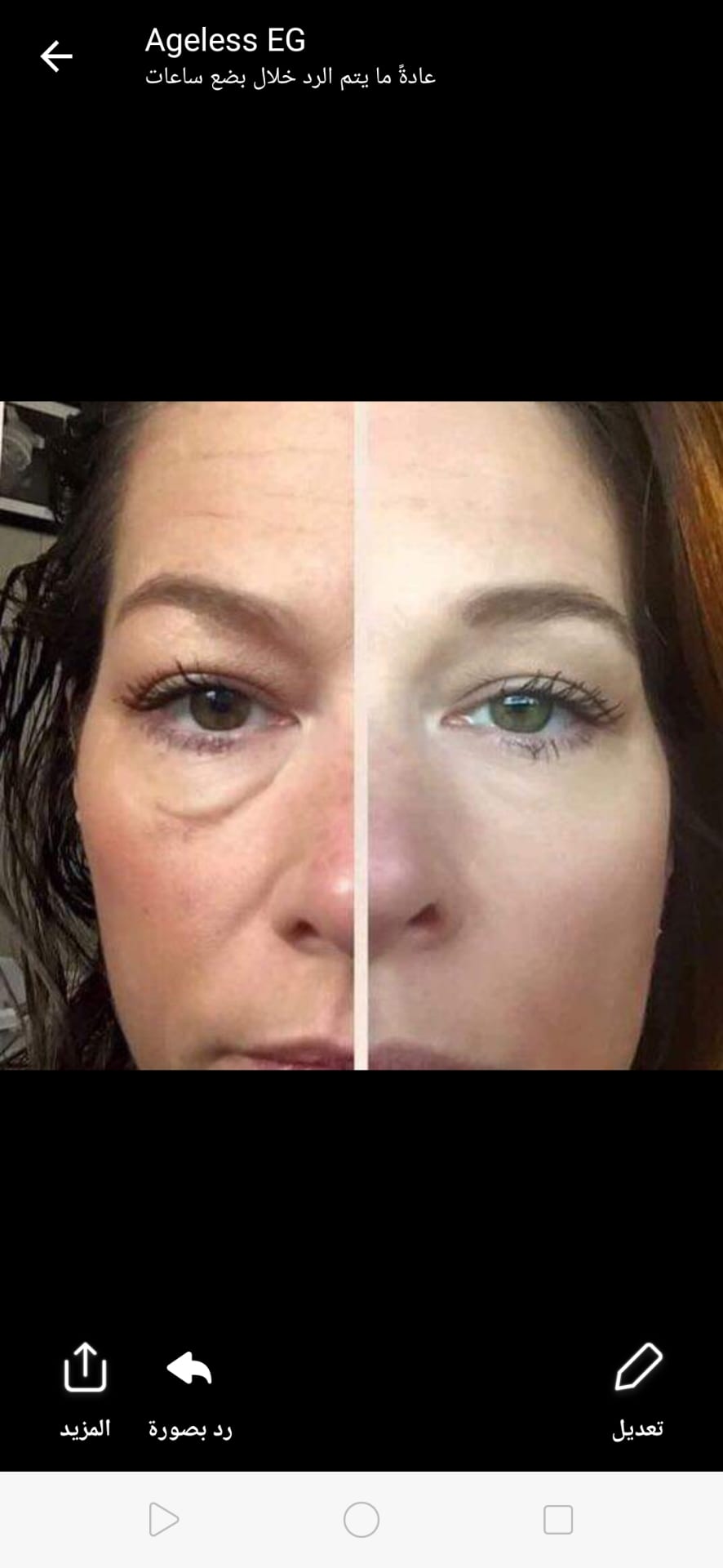 ageless cream
لا تنسَ أنك شاهدت هذا الإعلان في عنكبوت
الحل الامثل لمشكله التجاعيد و الانتفاخا...