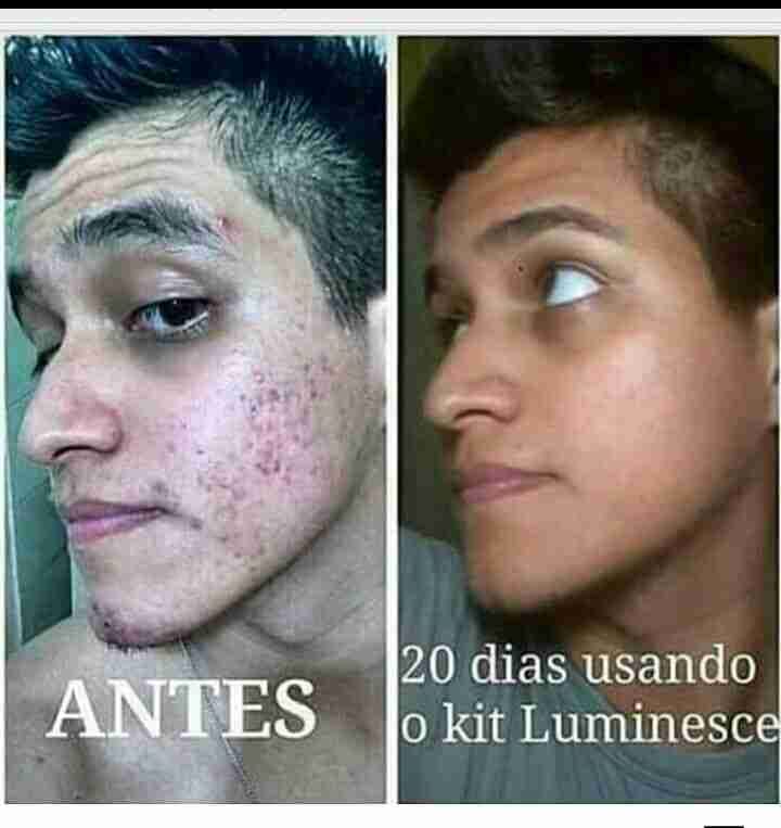 Luminesce products المنتج الامريكى
لا تنسَ أنك شاهدت هذا الإعلان في عنكبوت
مصل السيرم :- أقوي...