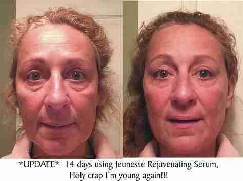 Luminesce products المنتج الامريكى
لا تنسَ أنك شاهدت هذا الإعلان في عنكبوت
مصل السيرم :- أقوي...